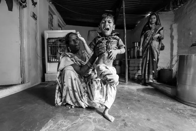 Manish, 4 years old, with his mother Pooja at home in the Mata ki Madiya neighborhood. Manish was born to parents contaminated by a carcinogenic and mutagenic water supply. (Photo by Giles Clarke/Getty Images)