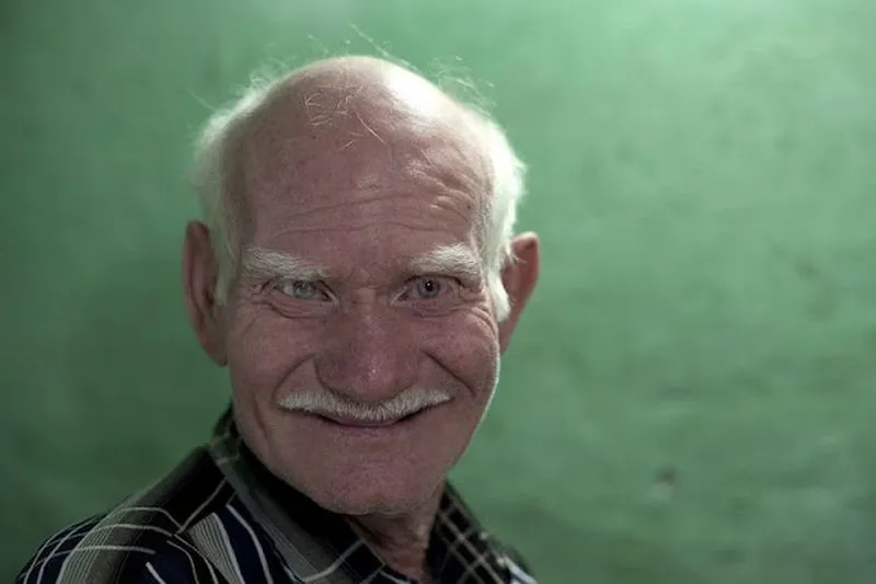 World's Biggest Albino Family