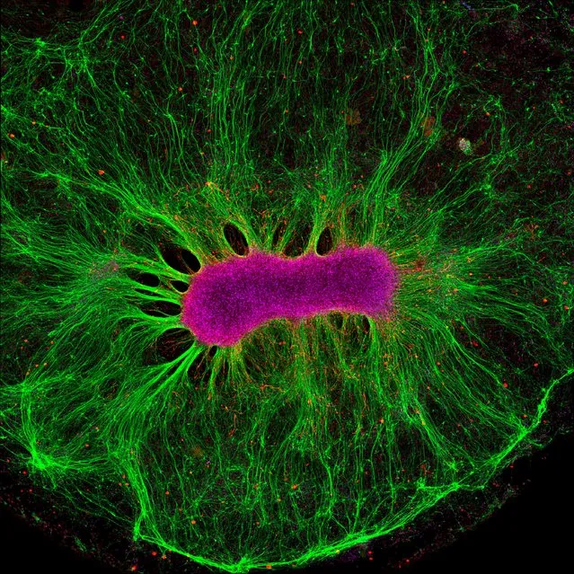 Brain-on-a-chip. Dazzling in green and magenta this image shows the nerve fibres (in green) produced by neural stem cells (in magenta) as they grow on a synthetic gel. Captured by a technique known as confocal microscopy, the image is part of research shedding light on how tinkering with the environment can affect the way in which nerve fibres grow. (Photo by Collin Edington and Iris Lee/Massachusetts Institute of Technology/Wellcome Images)