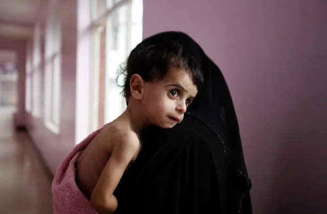 A woman holds her malnourished boy after he was weighed at a hospital malnutrition intensive care unit in Sanaa, Yemen September 27, 2016. (Photo by Khaled Abdullah/Reuters)