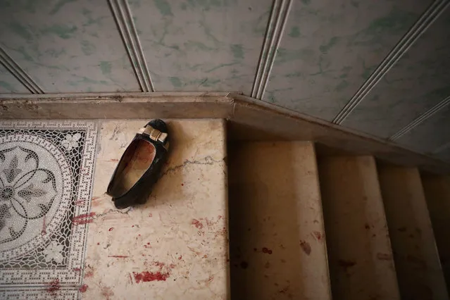 A picture taken on October 5, 2016 shows a shoe belonging to a victim at a make-shift hospital following reported air strikes on the rebel-held town of Douma, on the eastern outskirts of the Syrian capital Damascus. (Photo by Abd Doumany/AFP Photo)