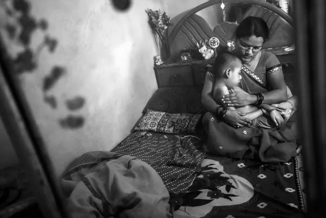 Rishikesh, 8 years old, with his mother Sangeeta at home in the Pushpa Nagar neighborhood. Rishikesh was born to parents contaminated by a carcinogenic and mutagenic water supply. (Photo by Giles Clarke/Getty Images)