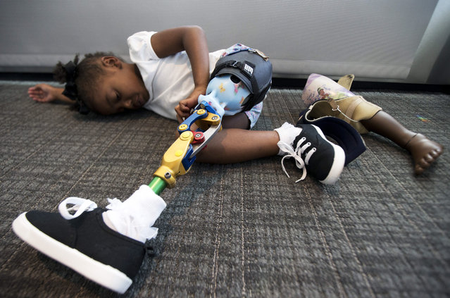 Miyah Williams, 3, wearing her prosthetic leg, rests in Washington, Friday, October 23, 2015, at a meeting on the need for new pediatric medical devices hosted by Children's National Health System. Miyah struggled with a painful and hard-to-move socket attaching her prosthesis until last August, when she received a new softer and more flexible kind. Miyah's old prosthesis lays on the floor. (Photo by Manuel Balce Ceneta/AP Photo)