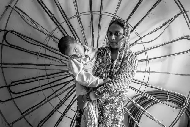 Mohd Anas, 7 years old, with his mother Kherunnisa at home in the Nawab Colony neighborhood. Mohd was born to parents contaminated by a carcinogenic and mutagenic water supply. (Photo by Giles Clarke/Getty Images)