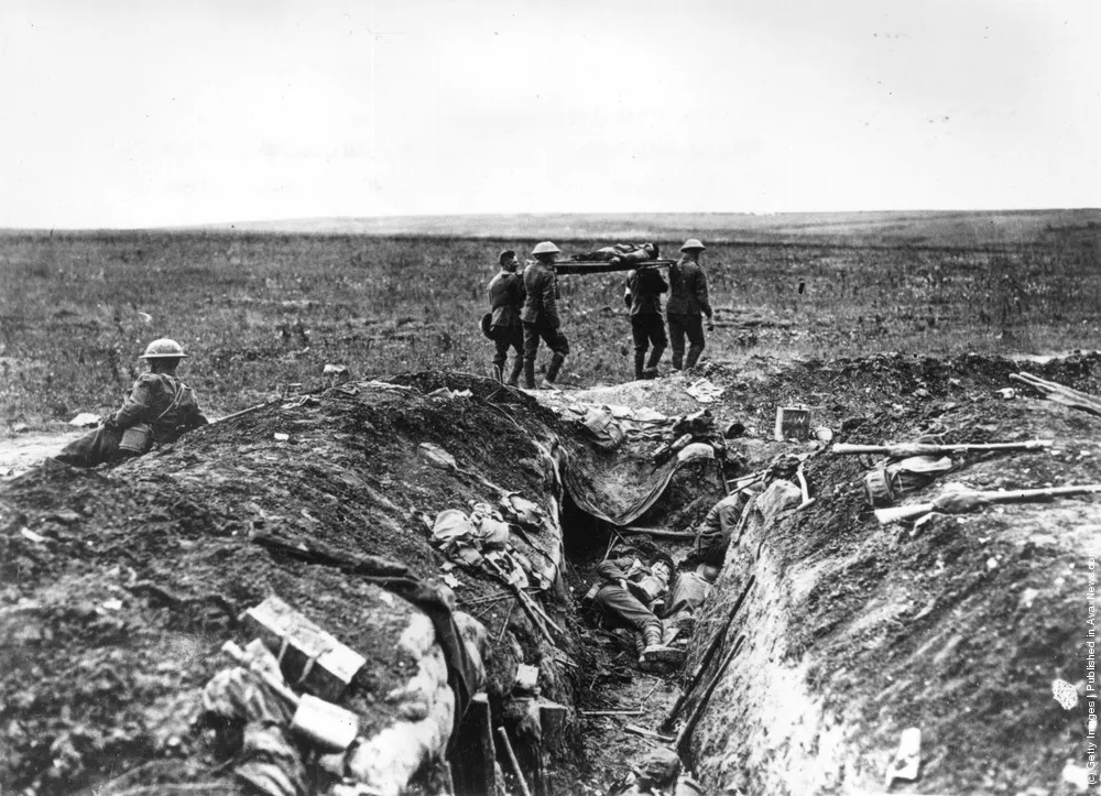 World War I: 1915 Year. Part I