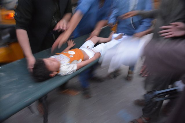 A boy who was injured in roof collapse due to torrential rains, is shifted to a hospital in Jalalabad, Afghanistan, 15 July 2024. At least 35 people were killed and 230 injured in eastern Afghanistan after heavy rain caused by thunderstorms led to collapsed trees, walls, and roofs of houses, Quraishi Badloon, head of the department of information and culture said. This tragedy follows previous flash floods in May that had devastating effects on the country's population. (Photo by Shafiullah Kakar/EPA/EFE)