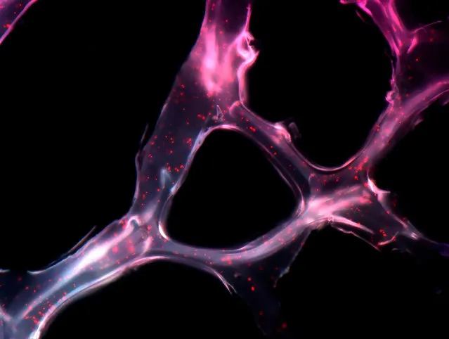 MicroRNA scaffold cancer therapy. This image shows a net-like structure, made from a synthetic polymer, that can be used to deliver two short, single-stranded genetic sequences known as microRNAs to cancer cells where they act to shrink tumours. The image was captured using scanning tunnelling microscopy – a technique that uses a beam of electrons to reveal the structure of objects. (Photo by João Conde. Nuria Oliva and Natalie Artzi/ Massachusetts Institute of Technology/Wellcome Images)