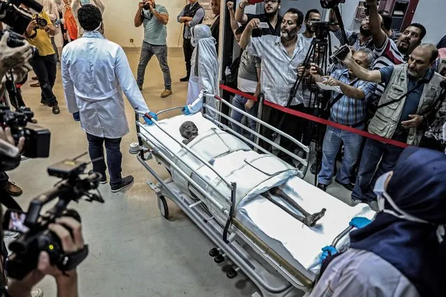 Journalists gather around the ancient Egyptian mummy of Sennedjem, an official who lived during the reigns of Pharaohs Seti I and Ramesses II in the 19th dynasty (13th-12th century BC), after being removed from its coffin for fumigation at the National Museum of Egyptian Civilization (NMEC) in the capital Cairo's Old Cairo district on September 21 , 2019. (Photo by Mohamed el-Shahed/AFP Photo)