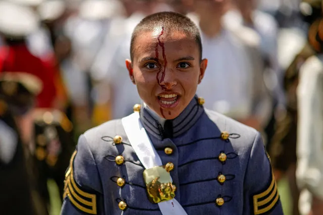 A graduated cadet bleeds after being hit by a hat tossed in the air, at the end of the 2023 graduation ceremony at the United States Military Academy (USMA), at Michie Stadium in West Point, New York, U.S., May 27, 2023. (Photo by Eduardo Munoz/Reuters)