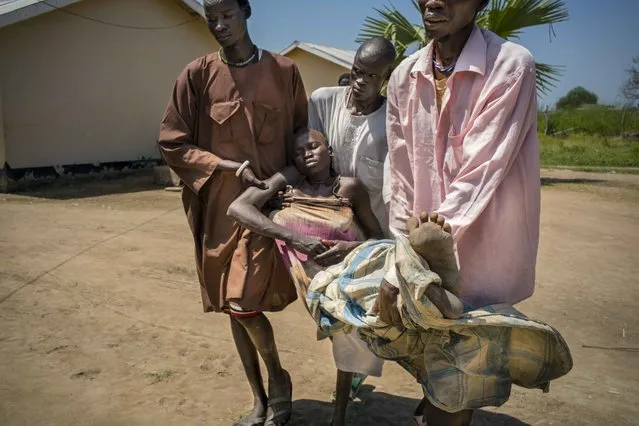 Panthou village, Aweil South county, Northern Bahr el Ghazal state, South Sudan on October 14, 2015. Thirty-two year old Arek Nuoi, mother of four, is carried by her family members to a hospital bed at Panthou Primary Health Care Center, where she will receive urgent treatment for acute malaria. She arrived unconscious, transported in a chair her family had tied to the seat of a bicycle, which they pushed for one and a half hours from their home village of Maper.  She had first shown signs of illness the previous night, complaining of headache and bodily pains. In the morning, she began to vomit and fainted. The health care center at Panthou is currently the only place where patients might be able to receive free treatment and medicine for malaria in the remote rural county of Aweil South. The center has only two staffs – both medical assistants – qualified to diagnose and treat patients, yet was treating approximately 150 malaria patients per day. In October 2015, the center had just received a supply of ACT oral medication for malaria, which they had been out of stock for two months. With the high number of patients, this new supply would be depleted in a week or two. The center also had a low stock of quinine, which they reserved for serious cases. There were no RDTs (rapid detection tests) in stock, so diagnosis could only be done clinically based on symptoms observed. (Photo by Diana Zeyneb Alhindawi)