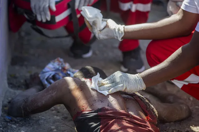 A wounded inmate is tended to after an attempted escape from the Croix-des-Bouquets Civil Prison in Port-au-Prince, Haiti, Thursday, February 25, 2021. At least seven people were killed and one injured on Thursday after eyewitnesses told The Associated Press that several inmates tried to escape from a prison in Haiti’s capital. (Photo by Dieu Nalio Chery/AP Photo)