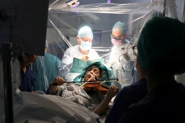 A still image take from handout video footage released by King’s College Hospital in London on February 19, 2020 and recorded on January 31, 2020, shows musician Dagmar Turner playing the violin during brain surgery at King's College Hospital in London. Turner played Mahler and Gershwin on the violin while a tumor was removed from her brain so that surgeons could preserve her ability to play music and her 40-year passion for the instrument. (Photo by King's College Hospital via Reuters)