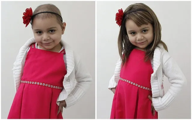 A combination of pictures shows Alexandra Munoz, 5, who lost her hair due to chemotherapy for a brain tumour, posing for a photograph without (L) and with a natural hair wig (R), which she received as a donation from hair stylist Marcelo Avatte in the cancer ward of the Luis Calvo Mackenna Hospital in Santiago, October 30, 2014. (Photo by Rodrigo Garrido/Reuters)