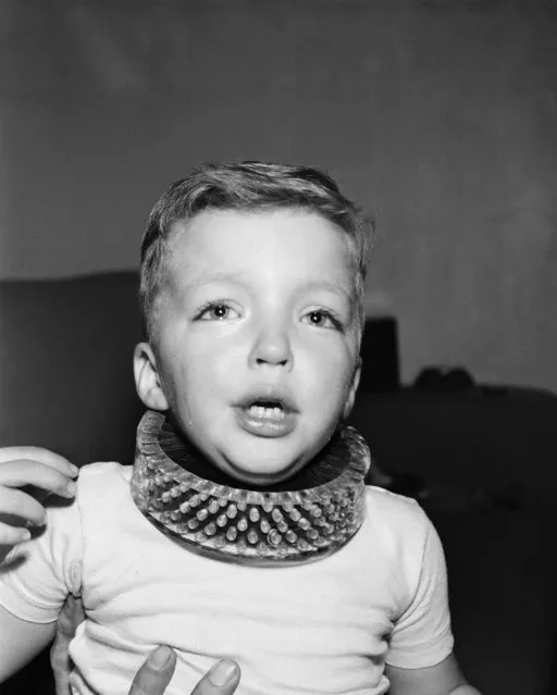 Five-year-old Tim Gregory wears, under protest, a brush that cleans a child's neck without the use of soap and water in Los Angeles, Calif., January 12, 1950. The plastic collar brush will dry-clean the youngster's neck thoroughly as he plays. The brush was developed by the Los Angeles Brush Corp. at a mother's suggestion. (Photo by Don Brinn/AP Photo)