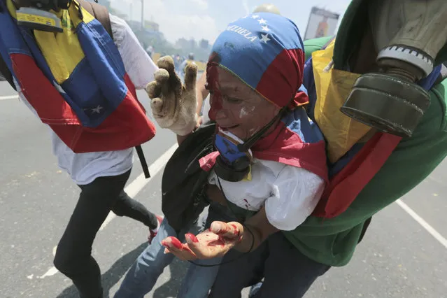 A woman injured during clashes with security forces is aided by fellow anti-government protesters in Caracas, Venezuela, Wednesday, April 26, 2017. Opponents of President Nicolas Maduro attempted to march into downtown Caracas in another day of protests that have already claimed 26 lives since the start of April. (Photo by Fernando Llano/AP Photo)