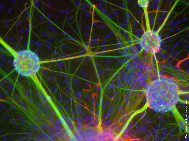 Primary rat neurons grown as neurospheres, observed by Dr. Rowan Orme of Keele University, Keele, UK