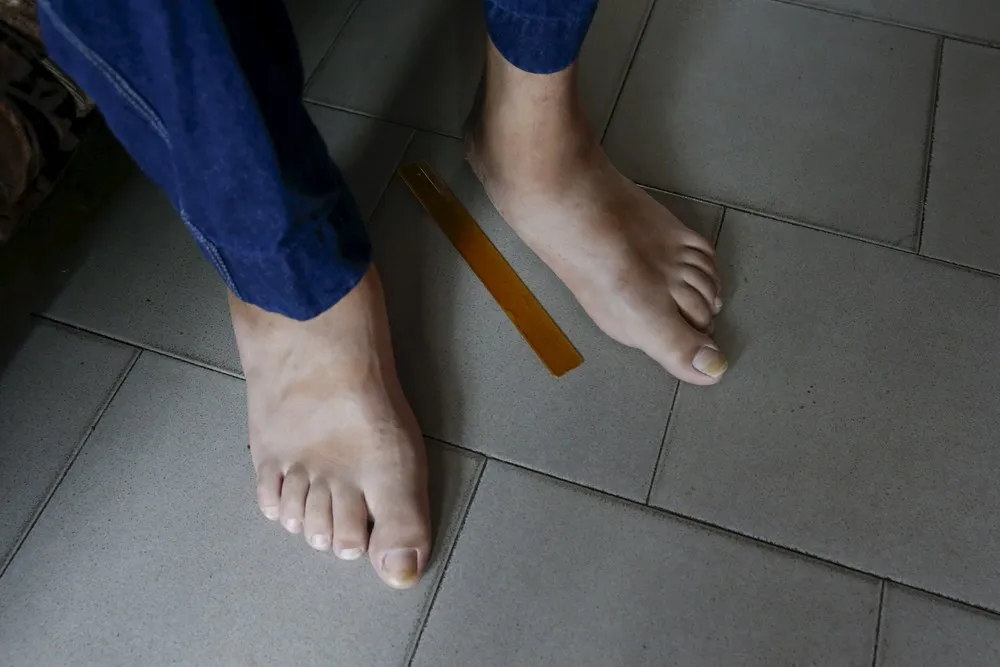 World's Biggest Feet