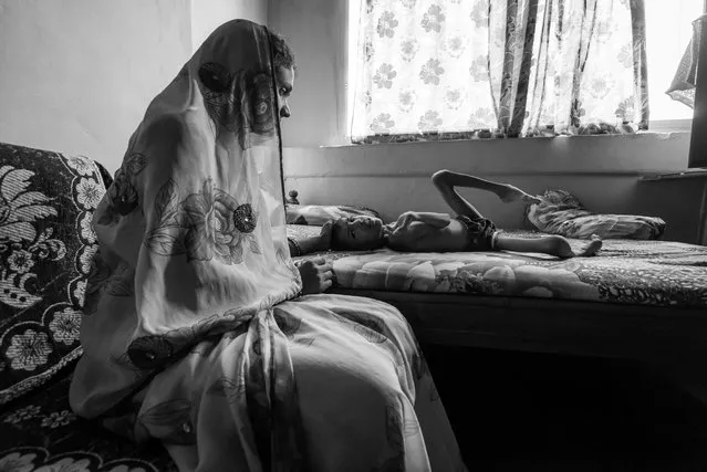 Devank Sahu, 8 years old, with his mother Sunita Sahu at home in the Risaldar Colony neighborhood. Devank was born to parents contaminated by a carcinogenic and mutagenic water supply. (Photo by Giles Clarke/Getty Images)