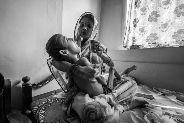 Devank Sahu, 8 years old, with his mother Sunita Sahu at home in the Risaldar Colony neighborhood. Devank was born to parents contaminated by a carcinogenic and mutagenic water supply. (Photo by Giles Clarke/Getty Images)