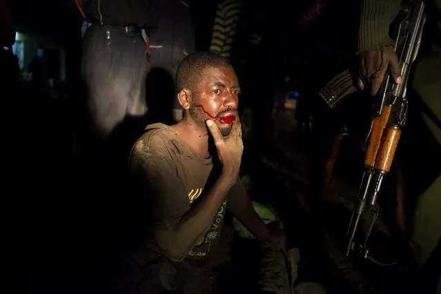 An injured man, who according to witnesses was pushed from a moving vehicle, spits blood as he lies on the side of a road in Nairobi, Kenya, October 30, 2015. The man could hardly stand due to his injuries and appeared to be intoxicated. (Photo by Siegfried Modola/Reuters)