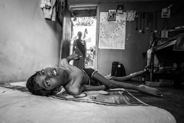 Raj, 10 years old, with his mother Puna Bai at home in the Shankar Nagar neighborhood. Humera was born to parents contaminated by a carcinogenic and mutagenic water supply. (Photo by Giles Clarke/Getty Images)