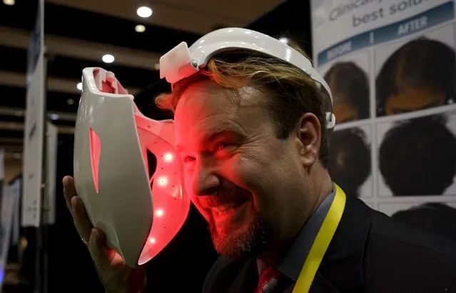 Jonathan Graff, director of clinical research for Apira Science demonstrates the company's iDerma Facial Beautification System, that is designed to treat various skin-related disorders, at the Consumer Electronics Show in Las Vegas January 4, 2016. (Photo by Rick Wilking/Reuters)