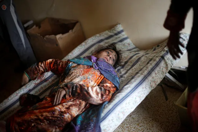An Iraqi girl, who was wounded during clashes in the Islamic State stronghold of Mosul, lies on a bed at a field hospital in al-Samah neighborhood, Iraq December 1, 2016. (Photo by Mohammed Salem/Reuters)