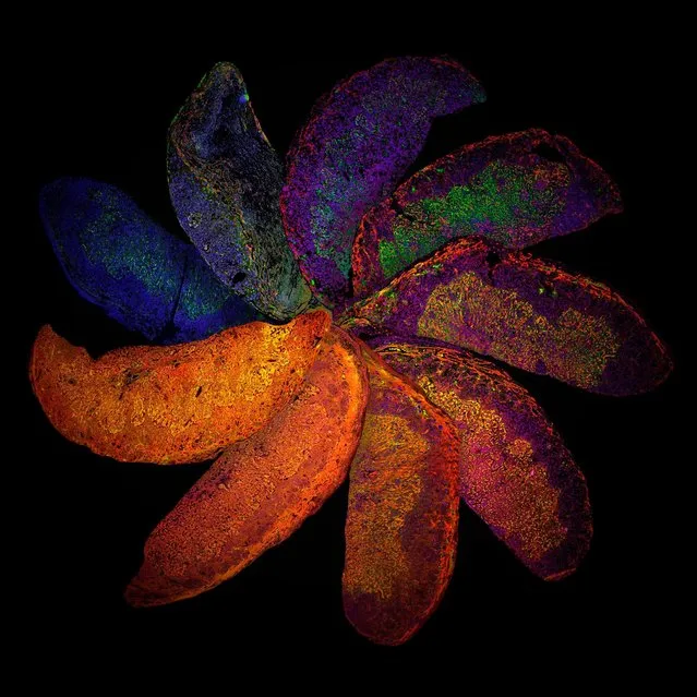 The Placenta Rainbow. Rich in oranges, blues and greens this is a vivid arrangement of mouse placentas. Captured through confocal microscopy, the image shows placentas taken from mice who have genetically different immune systems, highlighting how such differences can affect the structure of the placenta for example the development of blood vessels (shown in red) – an important consideration for conditions such as pre-eclampsia. (Photo by Suchita Nadkarni/William Harvey Research Institute/Queen Mary University of London/Wellcome Images)