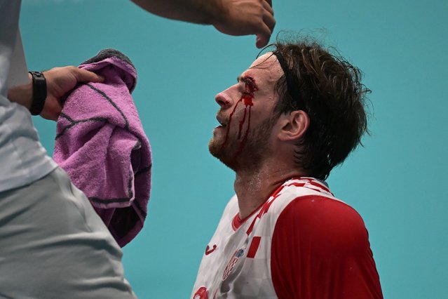 Croatia's pivot #93 Veron Nacinovic receives medical attention after sustaining an injury during the Men's Preliminary Round Group A handball match between Croatia and Germany of the Paris 2024 Olympic Games, at the Paris South Arena in Paris, on July 31, 2024. (Photo by Damien Meyer/AFP Photo)