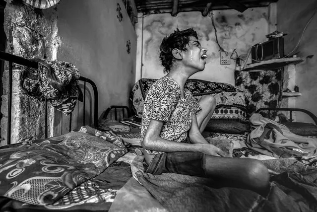 Huma, 14 years old, at home in the J.P. Nagar neighborhood. Huma was born to parents contaminated by a carcinogenic and mutagenic water supply. (Photo by Giles Clarke/Getty Images)