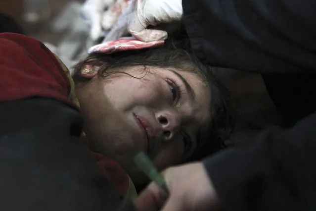 An injured child reacts in a field hospital after what activists said were air strikes by forces loyal to Syria's President Bashar al-Assad in Douma eastern Al-Ghouta, near Damascus January 25, 2015. (Photo by Badra Mamet/Reuters)