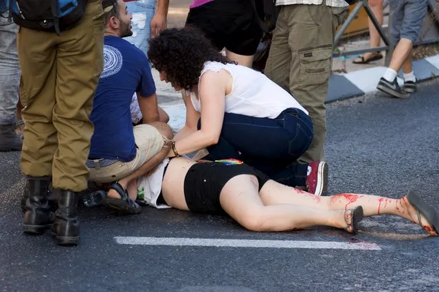 A participant of an annual gay pride parade is treated after an Orthodox Jewish assailant stabbed and injured six participants in Jerusalem on Thursday, police and witnesses said  July 30, 2015. (Photo by Carsten Seibold/Reuters)