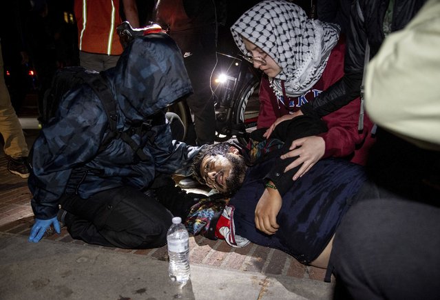 An injured person gets help at a pro-Palestinian encampment at UCLA late Tuesday, April 30, 2024, in Los Angeles. Dueling groups of protesters clashed at the University of California, Los Angeles, grappling in fistfights and shoving, kicking and using sticks to beat one another. (Photo by Ethan Swope/AP Photo)