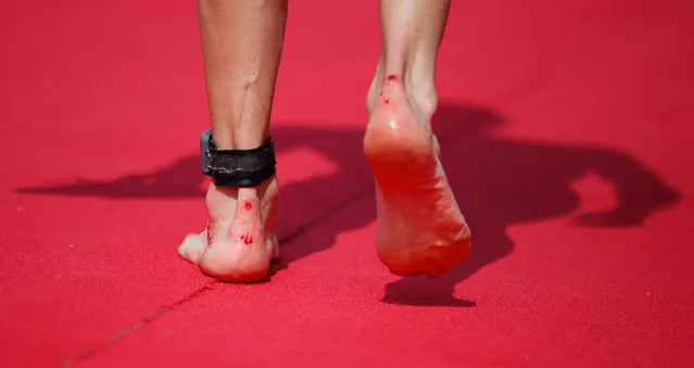 Injuries suffered by Pawel Miziarski of Poland are seen after the 6th edition of the Ironman 70.3 Dubai 2021 race in Gulf emirate of Dubai, United Arab Emirates, 12 March 2021. (Photo by Ali Haider/EPA/EFE)