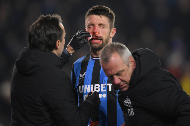 Club Brugge's Belgian defender #44 Brandon Mechele receives medical attention on the side of the pitch during the UEFA Champions League, league phase day 6, football match between Club Brugge (BEL) and Sporting CP (POR) at the Jan Breydelstadion in Bruges, on December 10, 2024. (Photo by John Thys/AFP Photo)