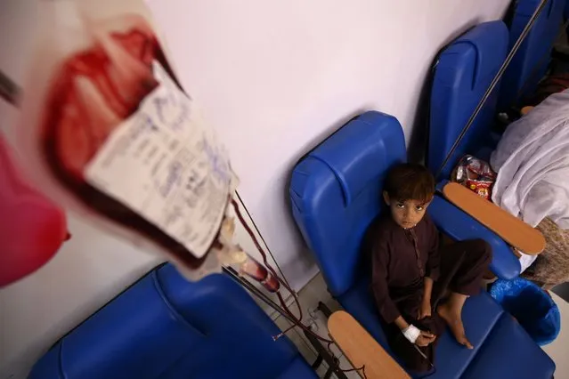 A Pakistani child suffering from the thalassemia blood disorder receives a blood transfusion at a Frontier Foundation medical center, on the World Thalassemia Day, in Peshawar, Pakistan, 08 May 2023. World Thalassemia Day is marked annually on 08 May and the 2023 theme is “Be aware. Share. Care.”,  with an aim of spreading awareness about thalassemia and the available treatment options. (Photo by Bilawal Arbab/EPA/EFE)