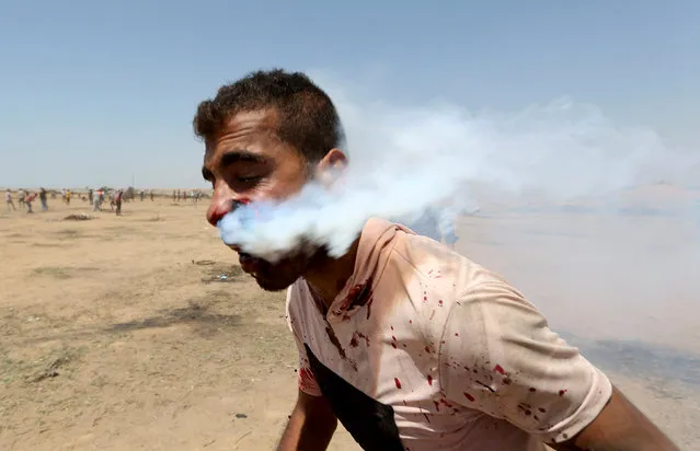 A wounded Palestinian demonstrator, Haitham Abu Sabla, 23, is hit in the face with a tear gas canister fired by Israeli troops during a protest marking al-Quds Day (Jerusalem Day) at the Israel-Gaza border in the southern Gaza Strip, June 8, 2018. (Photo by Ibraheem Abu Mustafa/Reuters)