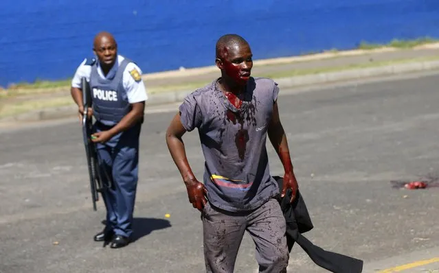 A bloodied demonstrator reacts after he was shot by police during a protest over evictions in Johannesburg March 18, 2015. Police fired rubber bullets to prevent protesters from marching to the mayor's office on Wednesday, according to local media. (Photo by Siphiwe Sibeko/Reuters)