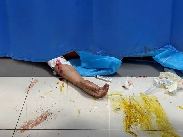 A Palestinian, who was wounded in an Israeli strike, lies on the floor at Shifa hospital in Gaza City on October 15, 2023. (Photo by Mohammed al-Masri/Reuters)