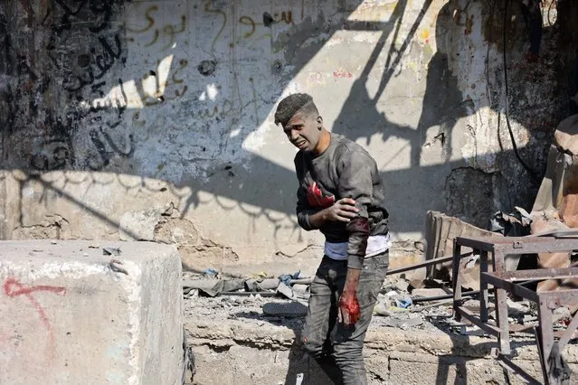 An injured Palestinian boy holds his arm as he walks away following Israeli bombardment on the Firas market area in Gaza City on April 11, 2024, amid the ongoing conflict between Israel and the Palestinian Hamas group. (Photo by AFP Photo/Stringer)