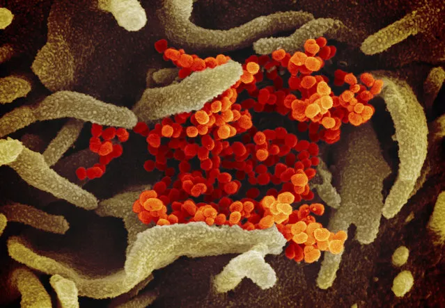 This image provided by The National Institute of Allergy and Infectious Diseases (NIAID). This scanning electron microscope image shows SARS-CoV-2 (orange)—also known as 2019-nCoV, the virus that causes COVID-19—isolated from a patient in the U.S., emerging from the surface of cells (green) cultured in the lab. (Photo by NIAID-RML via AP Photo)