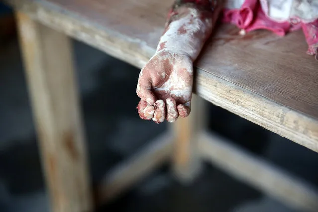 The hand of a dead child is pictured after shelling in the rebel held besieged town of Douma, eastern Ghouta in Damascus, Syria October 20, 2016. (Photo by Bassam Khabieh/Reuters)