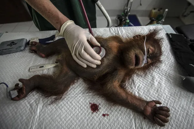 A baby orangutan receiving medical checkup at Sumatran Orangutan Conservation rehabilitation center in Batu Mbelin, North Sumatra, Indonesia on November 23, 2015. Three baby Sumatran orangutans were recovered recently after police arrested wildlife traffickers who smuggled them out of Aceh province. (Photo by Tanto H./Xinhua via ZUMA Wire)