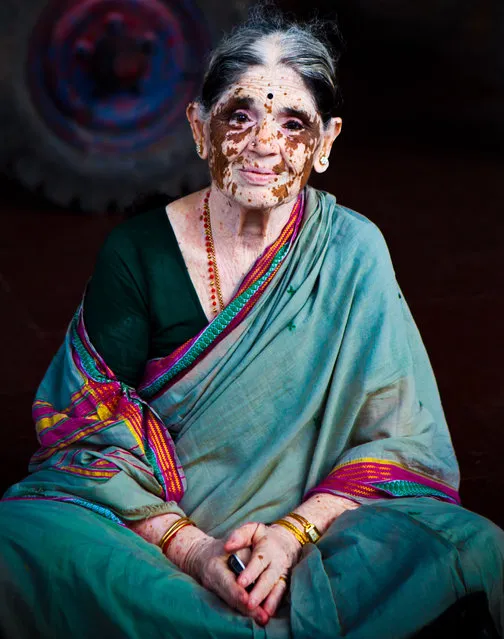 “Vitiligo woman”. Woman during her prayer inside of a temple. This beautiful lady has Vitiligo (Bolli in Telugu), a common disease with white patches appearing on the body.Unfortunately in India, a lot of social stigma is attached to the disease and patients are treated as outcasts some times. The social stigma in countries like India might be due to our dark complexion on which the white patches stand out. Photo location: hidambaram Temple, Chennai, India. (Photo and caption by Katarina Benzova/National Geographic Photo Contest)