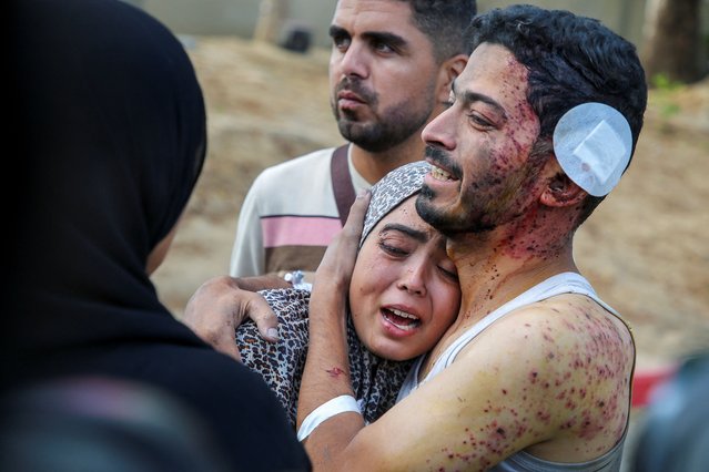 Palestinian man Ramadan Al-Zard, who was wounded in an Israeli strike that killed his relatives, embraces his niece who was injured along with him, amid the Israel-Hamas conflict, in Khan Younis in the southern Gaza Strip, on October 2, 2024. (Photo by Hatem Khaled/Reuters)