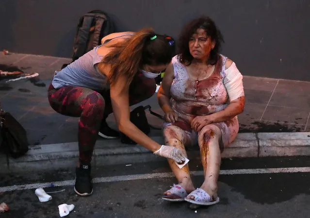 Wounded people wait to receive treatment outside a hospital following an explosion near the port in the Lebanese capital Beirut on August 4, 2020. Two huge explosion rocked the Lebanese capital Beirut, wounding dozens of people, shaking buildings and sending huge plumes of smoke billowing into the sky. Lebanese media carried images of people trapped under rubble, some bloodied, after the massive explosions, the cause of which was not immediately known. (Photo by Ibrahim Amro/AFP Photo)