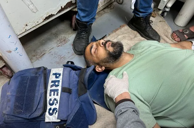 Palestinians journalist Sami Shehada, wounded in an Israeli strike, lies on the floor at Al-Aqsa hospital, amid the ongoing conflict between Israel and Hamas, in Deir Al-Balah in the central Gaza Strip, on April 12, 2024. (Photo by Doaa Rouqa/Reuters)