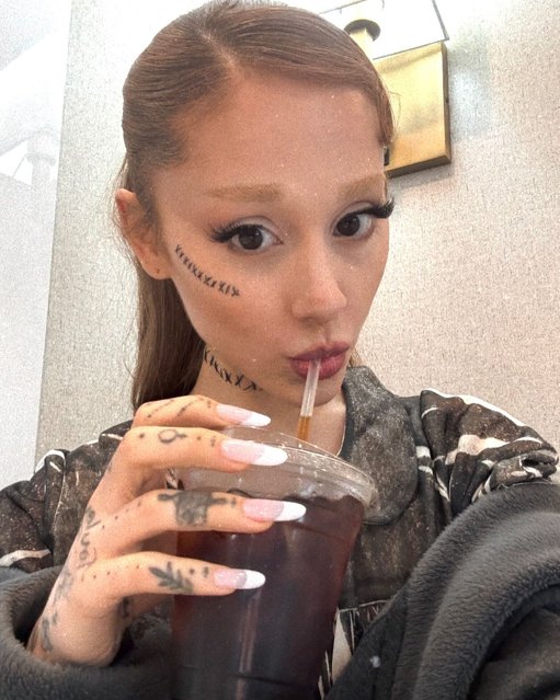 American singer-songwriter Ariana Grande gets some stitches for a music video shoot in the first decade of April 2025. (Photo by arianagrande/Instagram)