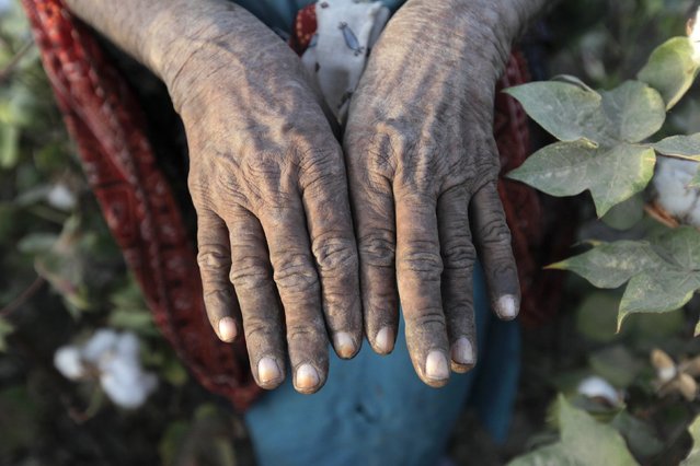 A woman cotton picker shows her hands as she poses for a picture in cotton fields near Meeran Pur village, north of Karachi September 25, 2014. (Photo by Akhtar Soomro/Reuters)