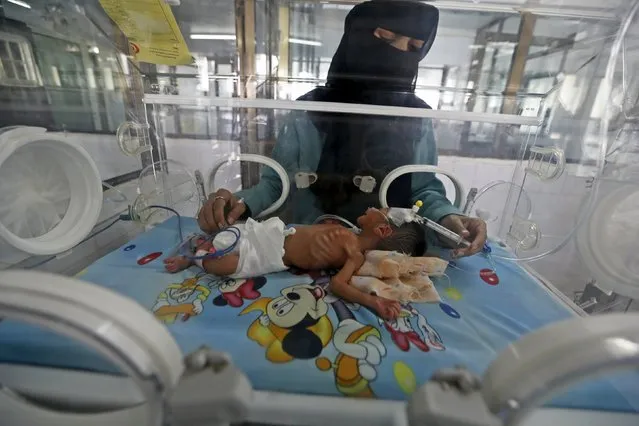 A doctor attends to a newborn baby in a special care unit at a hospital in Yemen's capital Sanaa May 7, 2015. A shortage of fuel has crippled hospitals and food supplies in recent weeks in Yemen, and the U.N.'s World Food Programme has said its fuel needs have leapt from 40,000 litres a month to 1 million litres. (Photo by Khaled Abdullah/Reuters)